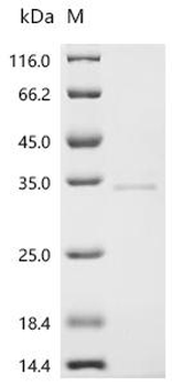 E.coli CTSK protein