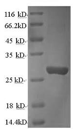Rat Ctsk protein