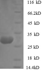 Rabbit Ctsk protein