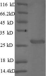 Mouse ctss protein