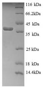 Human CYCS protein