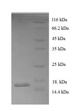 Human DBI protein