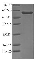Human DDX58 protein