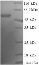 Human DNAJB2 protein