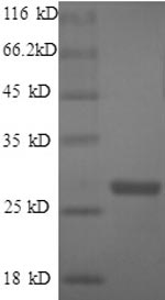 E.coli tmk protein