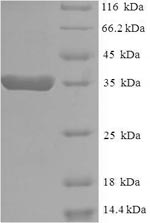Human EEF1E1 protein