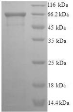 Human EIF5 protein