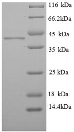 Human ELAVL2 protein