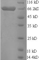 Pig ETFDH protein