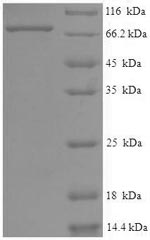 Human EYA2 protein