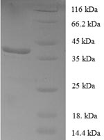 Human FOXP1 protein