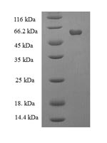 Human GALT protein
