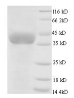 E.coli GAPDH protein