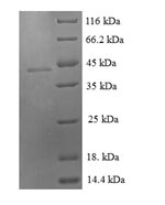 Human GDF9 protein
