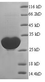 Human GLIPR1 protein