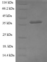 Human GNPDA1 protein