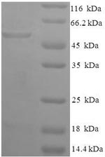 Human GPD1 protein