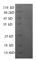 Human GTF2F2 protein