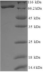 Human HDAC1 protein
