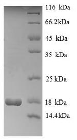 Human HIST1H2AG protein