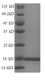 Mouse Hist1h2bm protein