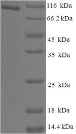 Human HJURP protein