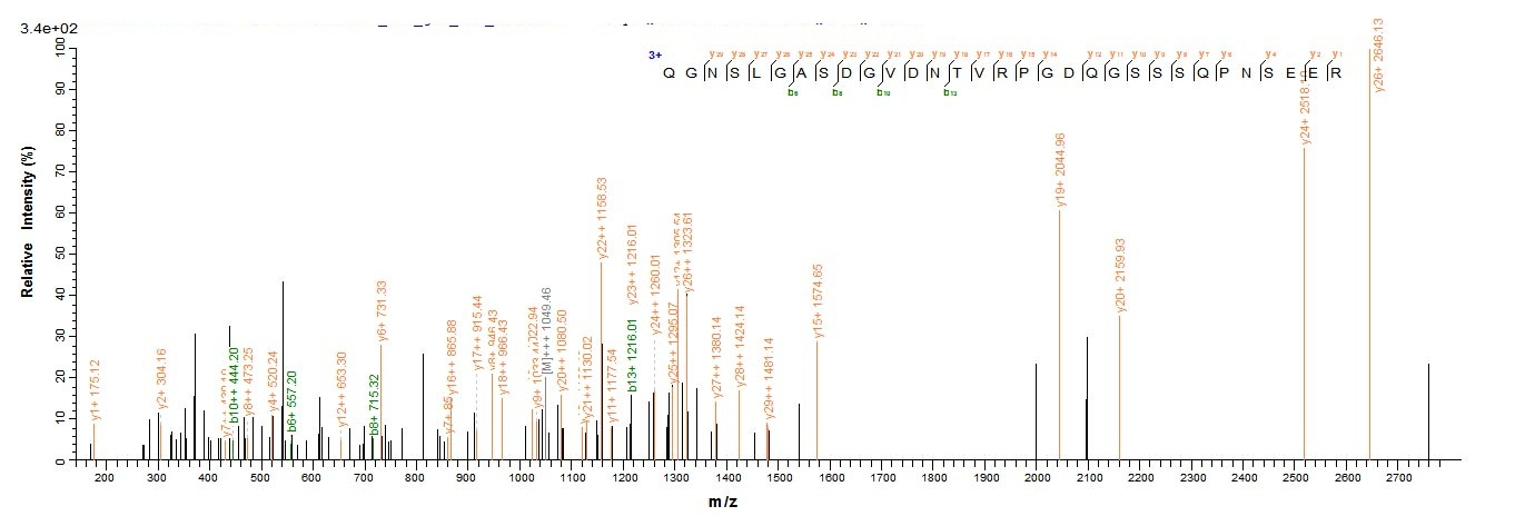 Human HJURP protein