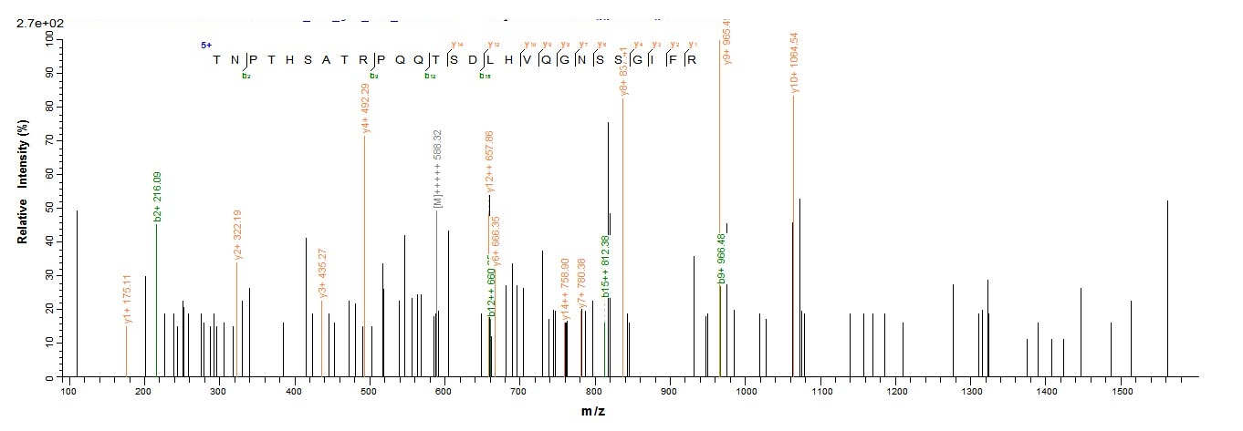 Human HJURP protein