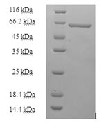 Human HNRNPH1 protein