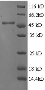 Human HPD protein