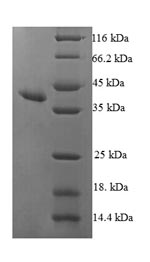 Human HRSP12 protein
