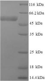 Human IDH3G protein