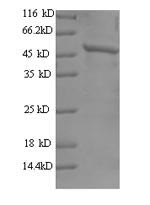 Human JAK2 protein