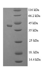 Human KLK1 protein