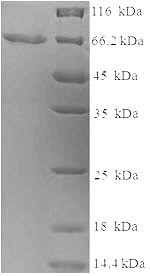 Human KRT14 protein
