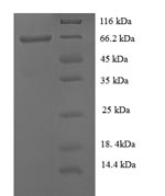 Human KRT38 protein