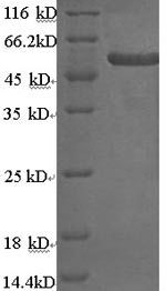 Human KRT4 protein