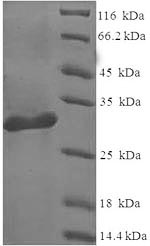 Human LGALS1 protein