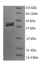 Human LIAS protein
