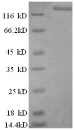 Human LIG1 protein