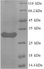 Human LILRA5 protein