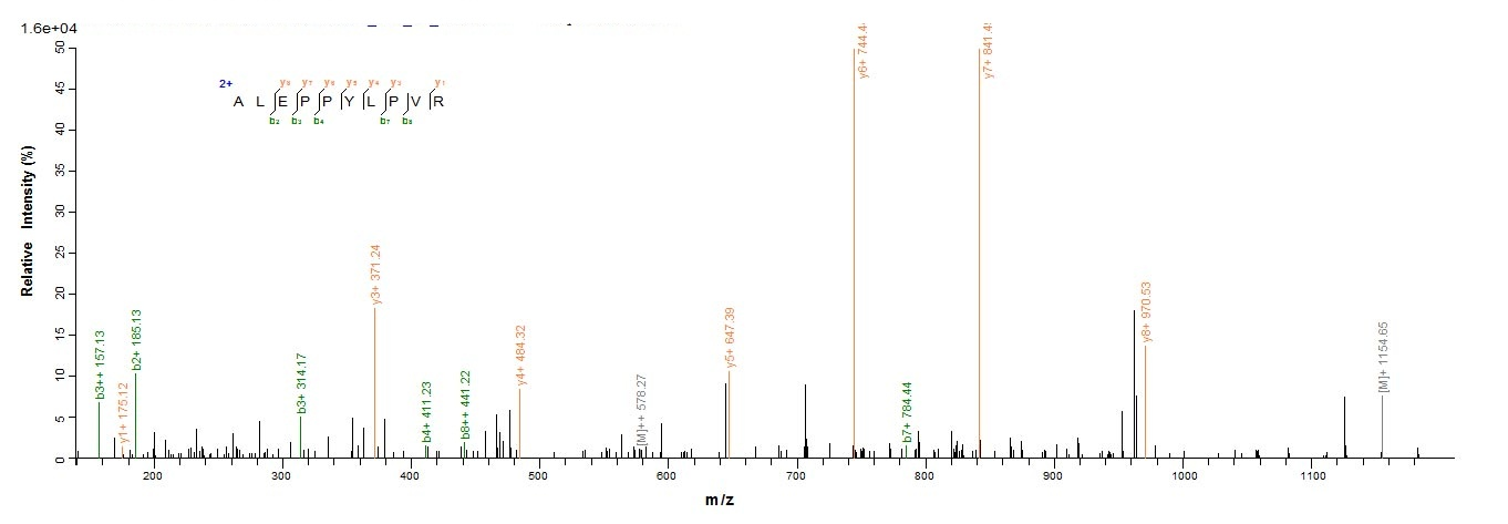 Human LOXL1 protein