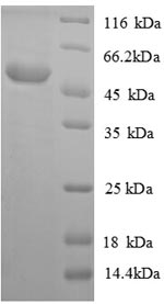 Mouse Lypla1 protein