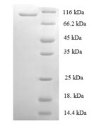 Human MCM2 protein