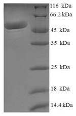 Human MDH2 protein