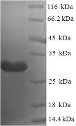Human NANOS2 protein