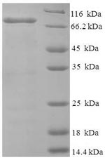 Human NDST1 protein