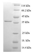 Human NDUFA3 protein