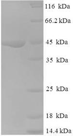 Human NDUFA6 protein