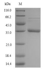 E.coli acpP protein